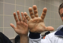 Hand of a Ukrainian World Champion in Arm Wrestling Denis Tsiplenkov