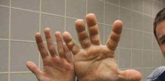 Hand of a Ukrainian World Champion in Arm Wrestling Denis Tsiplenkov