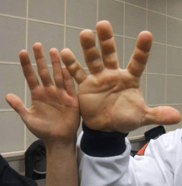 Hand of a Ukrainian World Champion in Arm Wrestling Denis Tsiplenkov