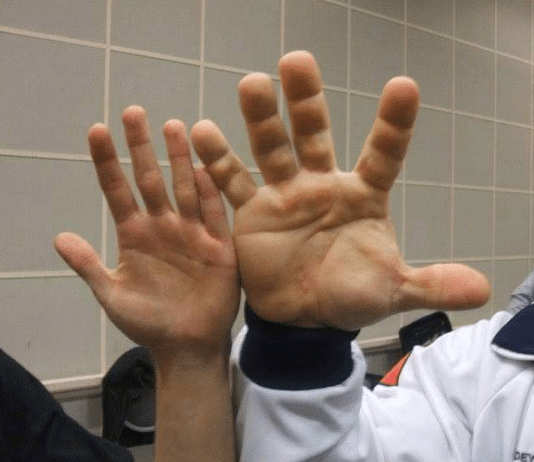 Hand of a Ukrainian World Champion in Arm Wrestling Denis Tsiplenkov