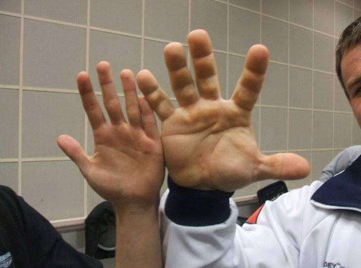 Hand of a Ukrainian World Champion in Arm Wrestling Denis Tsiplenkov.